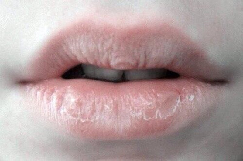 Itchy Lips: Causes And Prevention | Vinmec